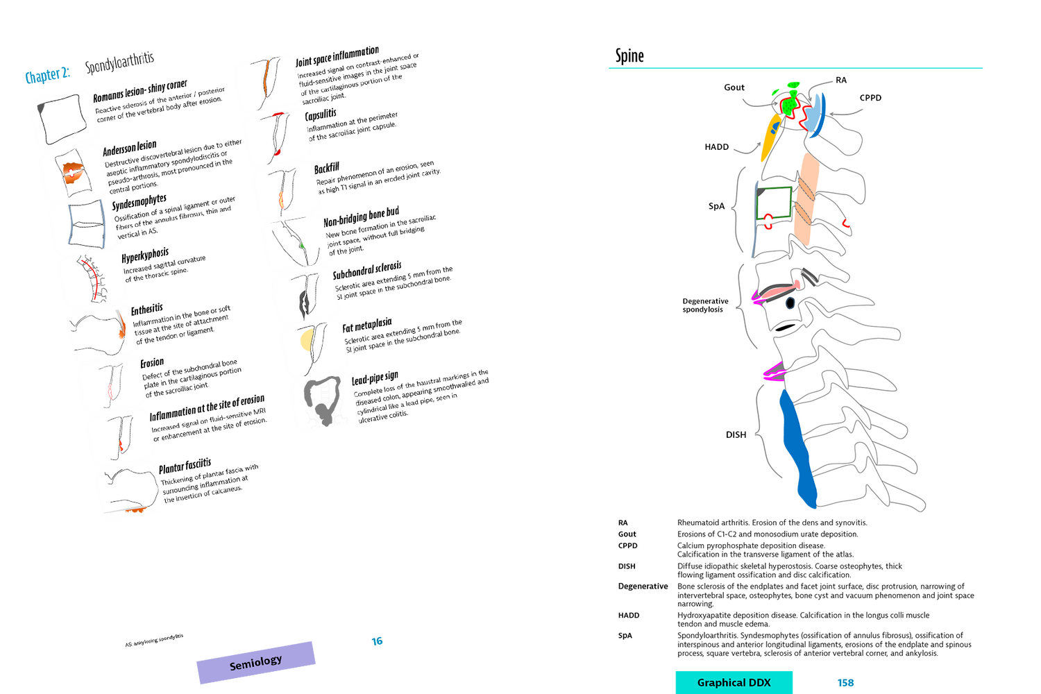 semiology spondylo arthritis and overview pathology sprine