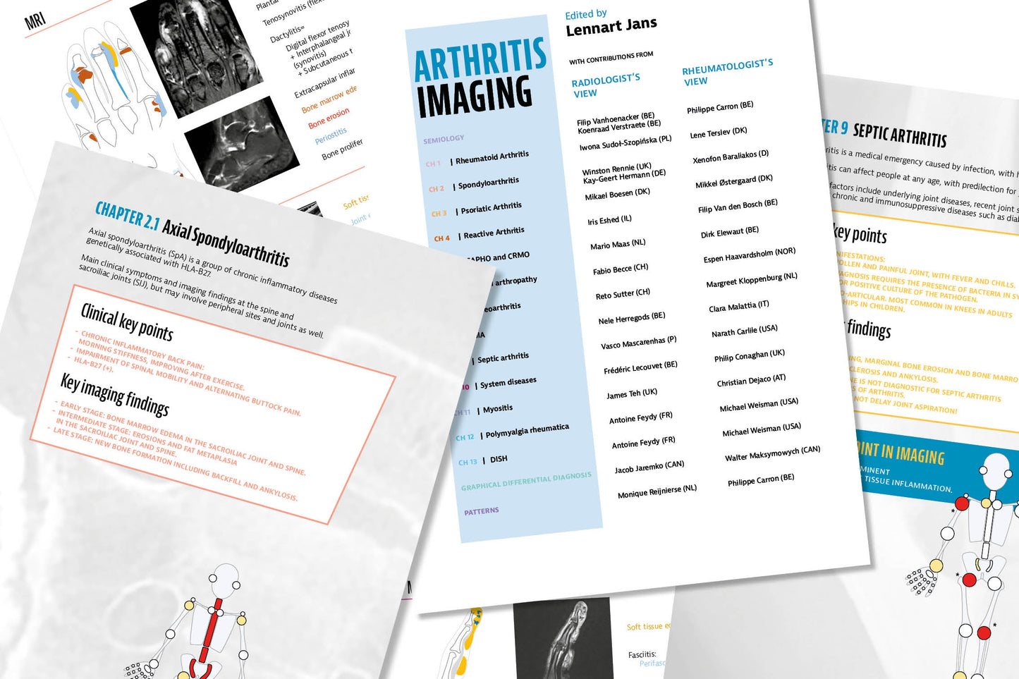 ARTHRITIS IMAGING